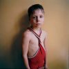 This is a color photograph of a young boy in a red singlet with a blackened right eye.