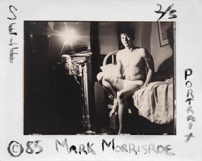 This is a black-and-white photograph of a man in white briefs with a bandaged leg sitting on a bed in a messy room.