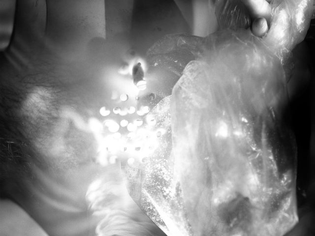 This black and white photograph shows a naked man from the waist down. There are bright flashes of white light surrounding his skin, set against a black background.