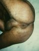 A color photograph of a man's hairy bum.